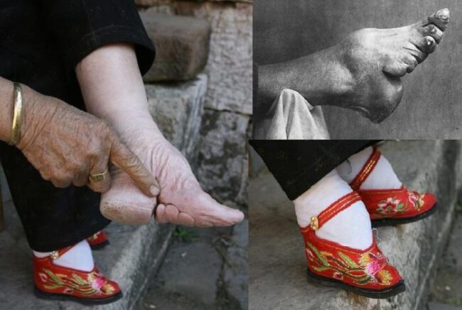 piedi-bendati-donne-cina-loto-oro-3